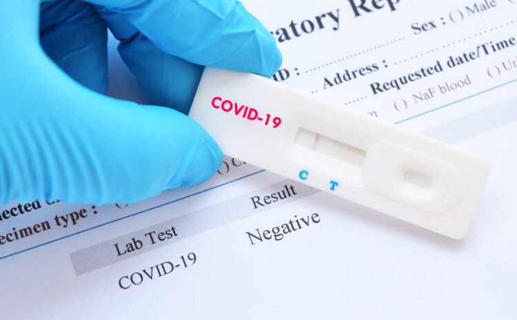  Тест на COVID – 19 (коронавирус)
